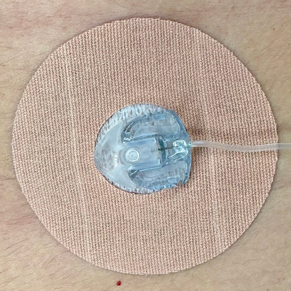 Katheterschutz für Insulinpumpen, 10 Stück | Kompatibel mit allen Kathetern | Braun 
