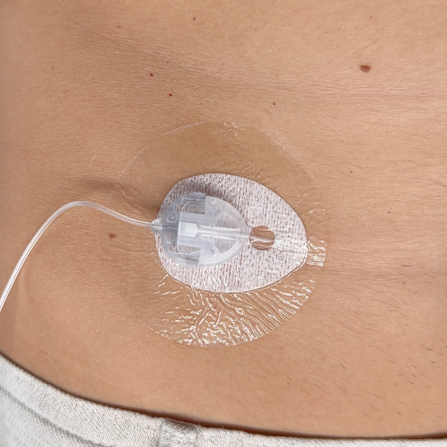 INSULIN PUMP CATHETER PROTECTOR 10pc | Transparent