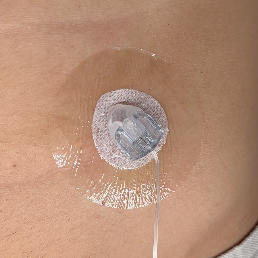 INSULIN PUMP CATHETER PROTECTOR 10pc | Transparent