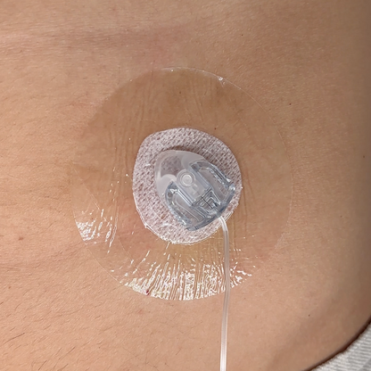 Insulin Pump Catheter Protectors, 10 Count | Compatible with all catheters | Transparent 