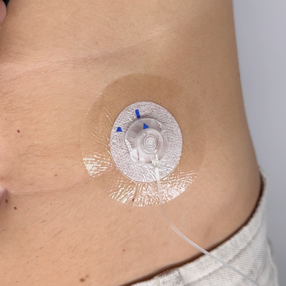 Insulin Pump Catheter Protectors, 10 Count | Compatible with all catheters | Transparent 